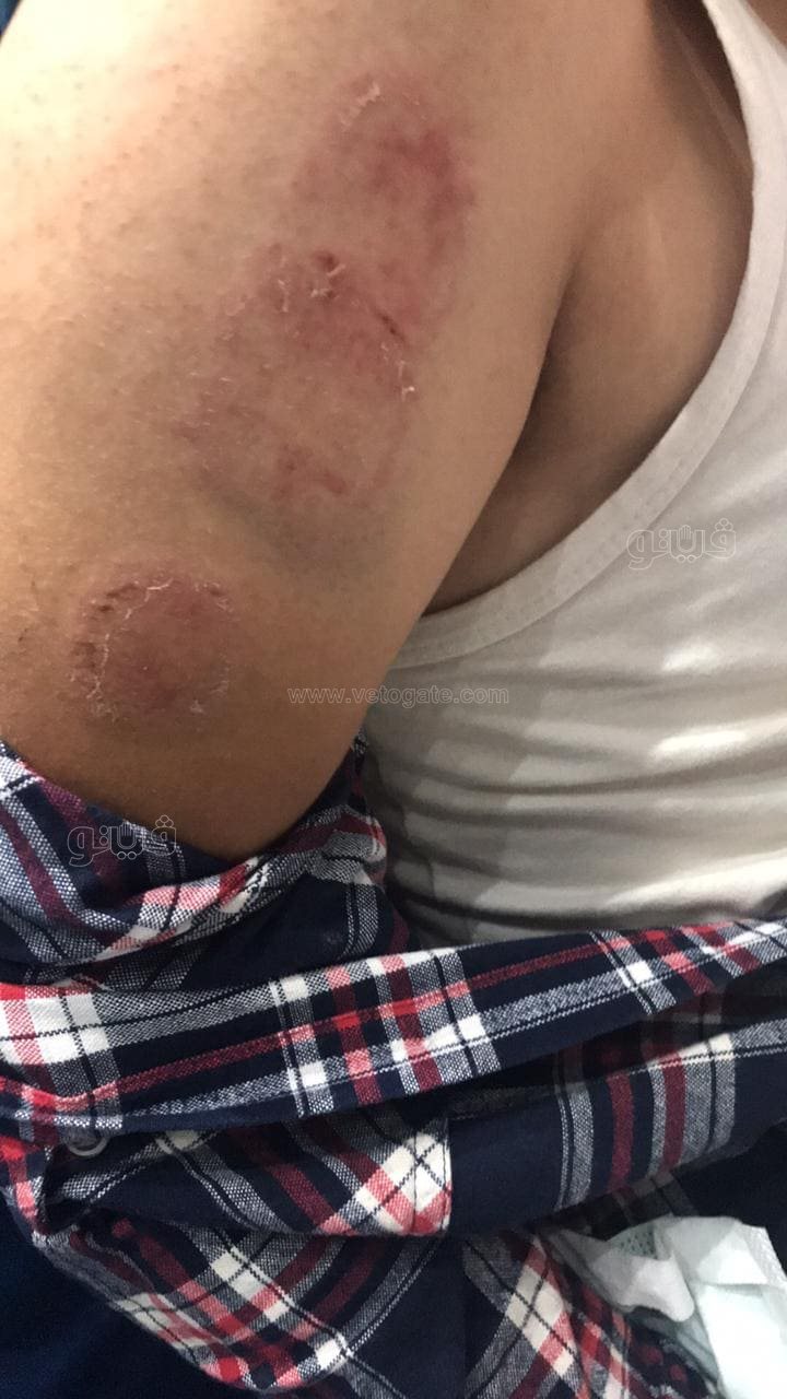 23