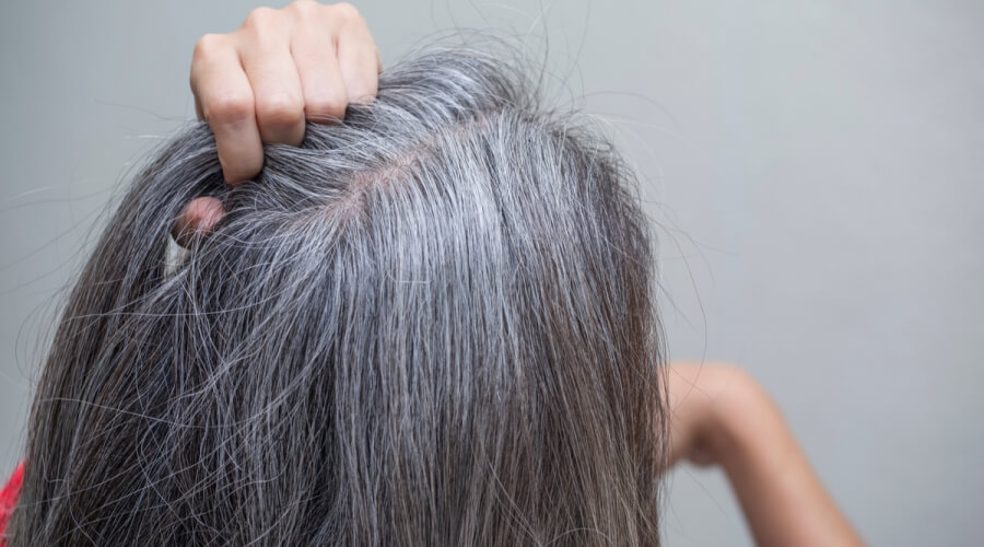 وصفة طبيعية لعلاج الشعر الأبيض&nbsp;