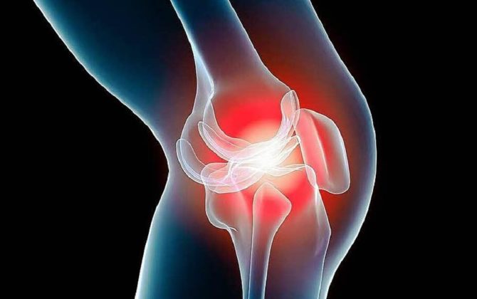 أعراض التهاب المفاصل&nbsp;