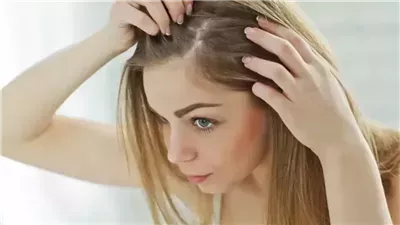 علاج تساقط الشعر&nbsp;