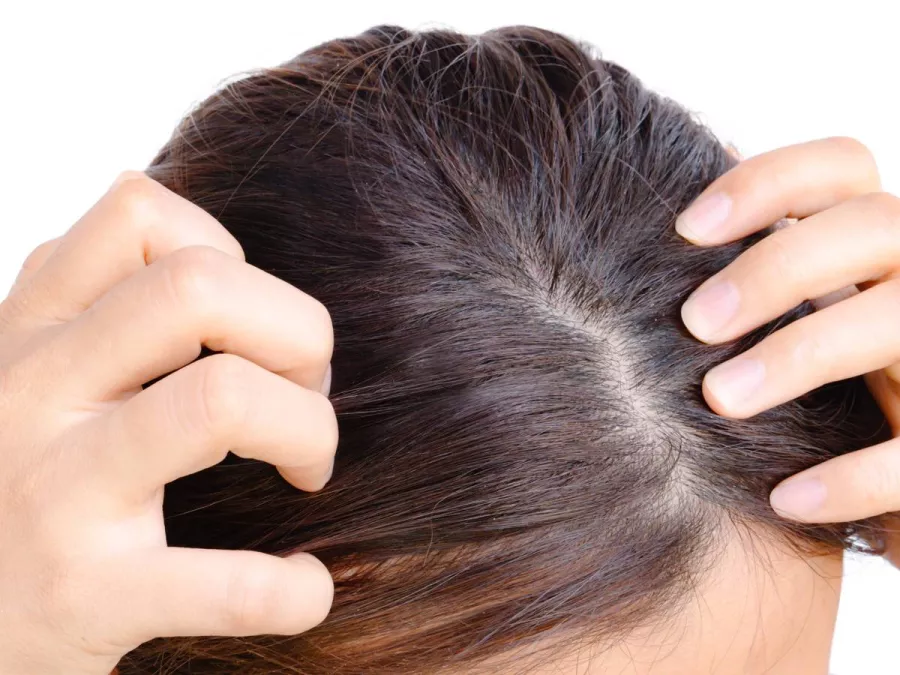 مخاطر تغطية الشعر