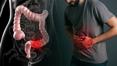 وصفة طبيعية لعلاج الإمساك&nbsp;