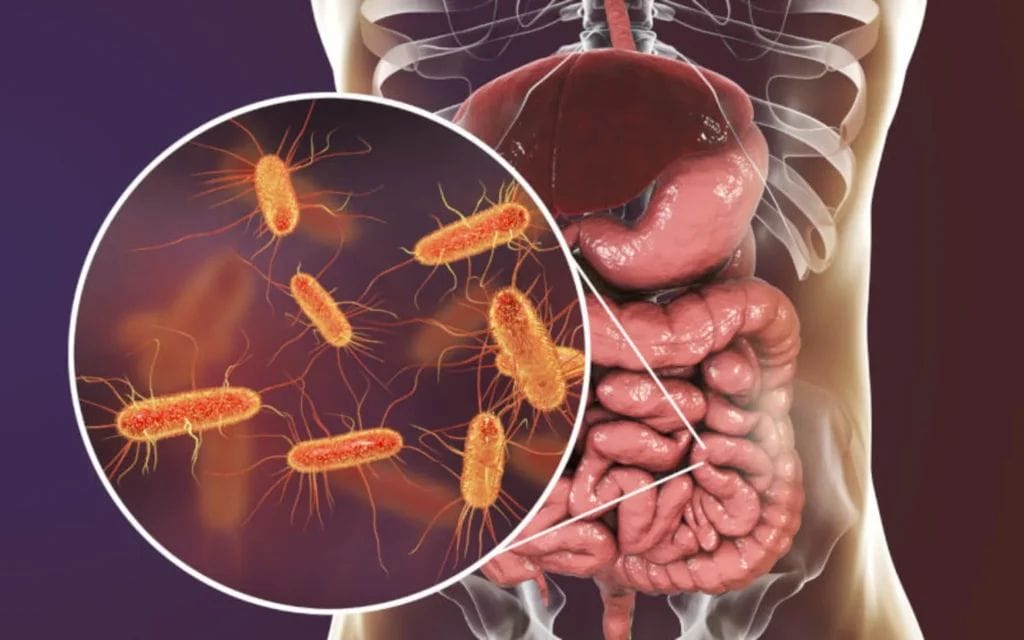 3 خطوات تساعد فى علاج مرض السيبو&nbsp;