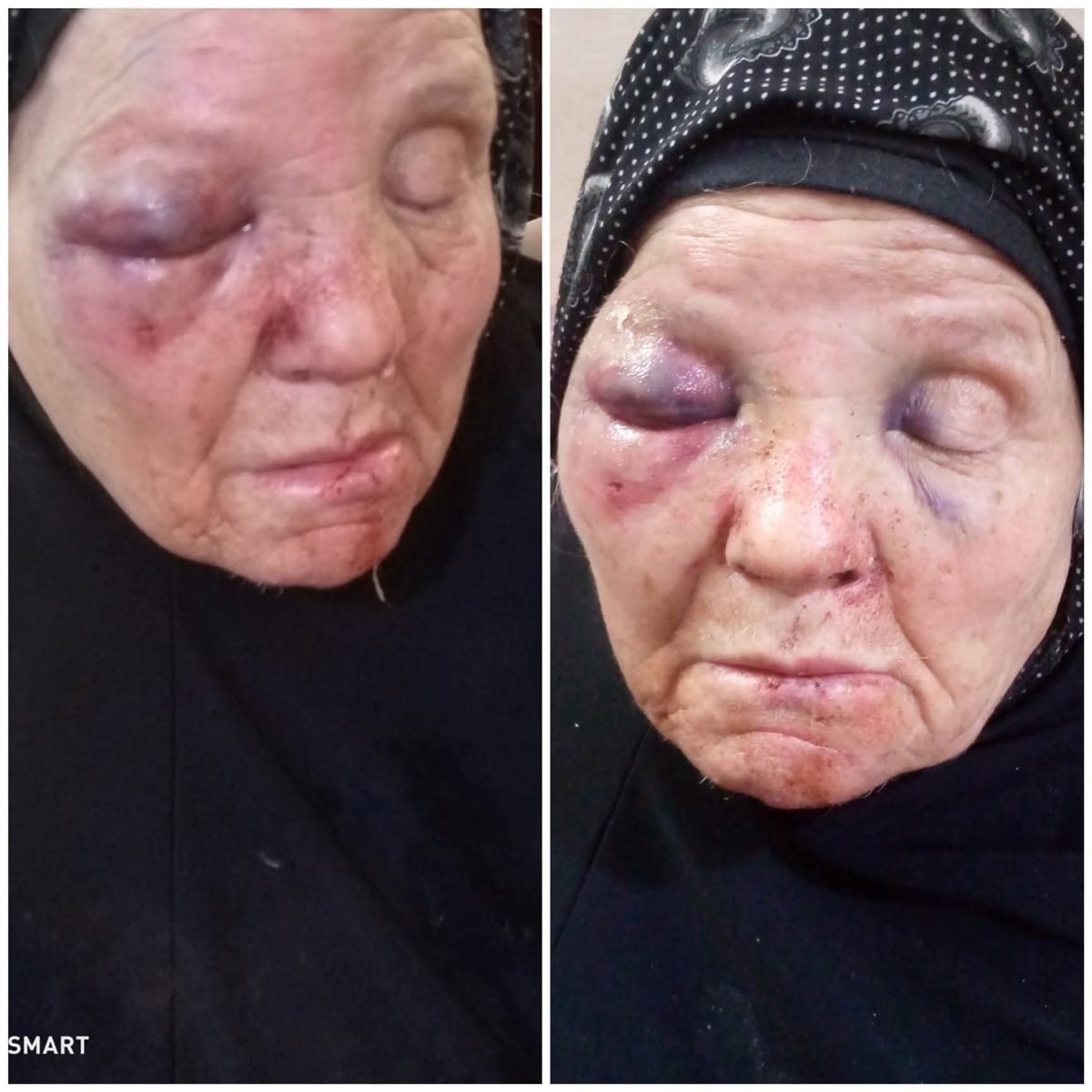 ضبط شاب بتهمة الاعتداء على والدته المسنة داخل منزلها في الغربية