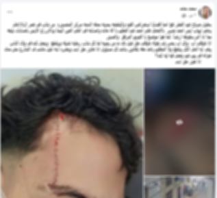 ضبط مرتكب التعدي على نجل شقيقه بالدقهلية بعد تداول الفيديو على مواقع التواصل الاجتماعي