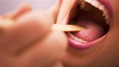 أسباب التهاب اللوزتين عند الأطفال&nbsp;