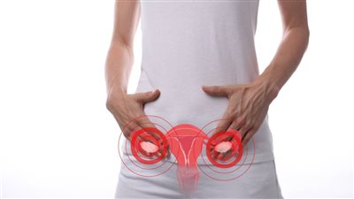 علامات تؤكد إصابتك بتكيسات المبايض