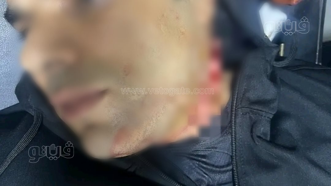 المجني عليه