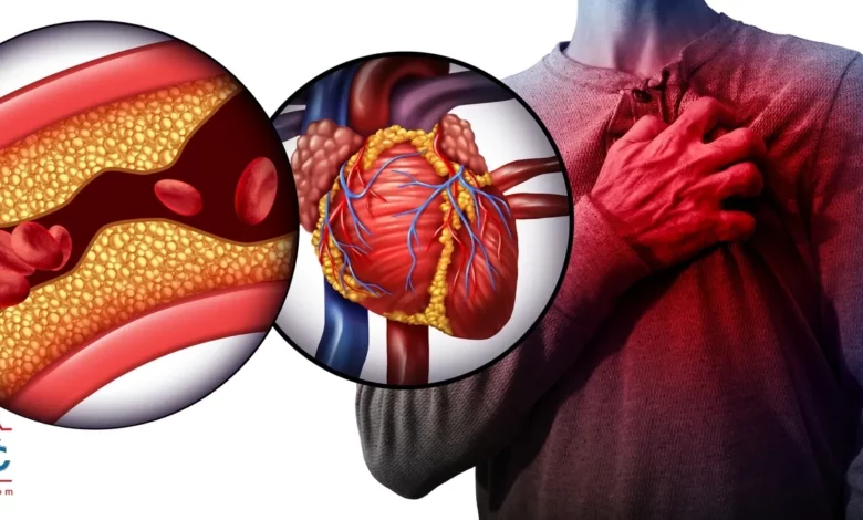 علامات تؤكد اقتراب الإصابة بجلطات القلب&nbsp;