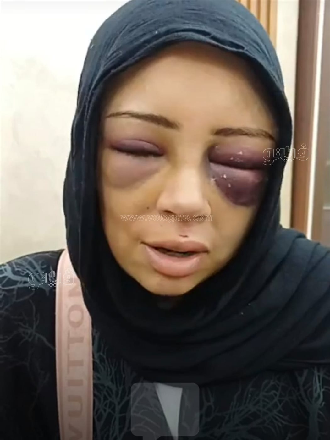 صورة الفتاة المعتدي عليها ببورسعيد، ڤيتو
