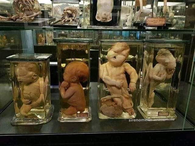 متحف الاجنة بقصر العيني