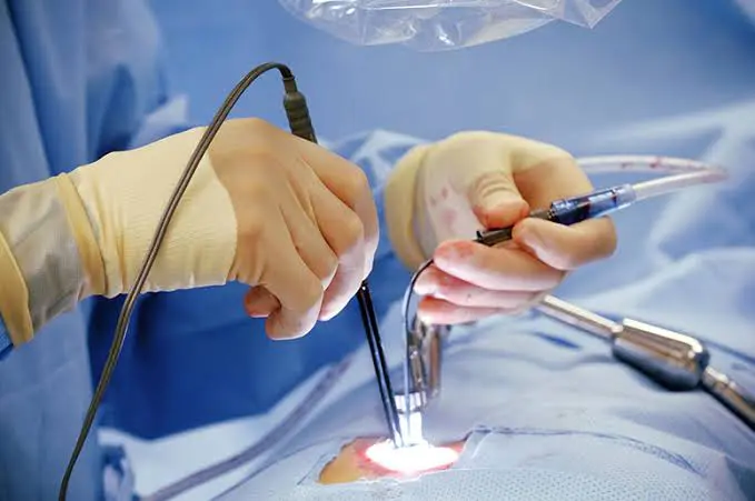 جمال شعبان يكشف حقيقة إجراء الطبيب المزيف لعمليات القلب المفتوح، فيتو