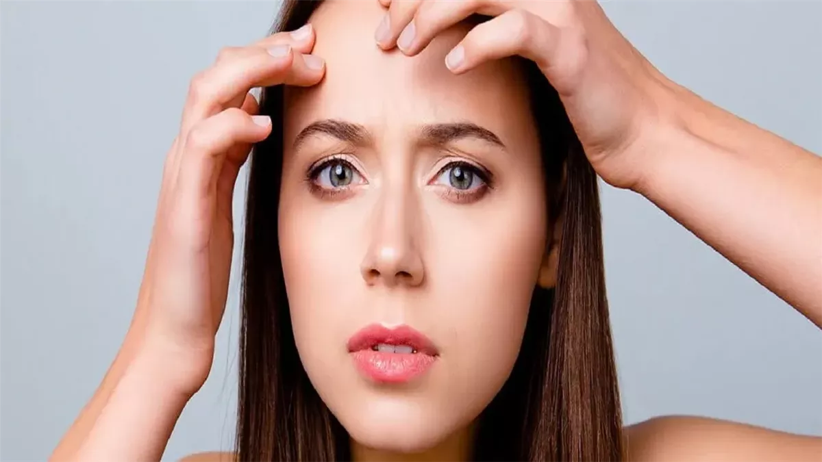 التخلص من حبوب الجبهة