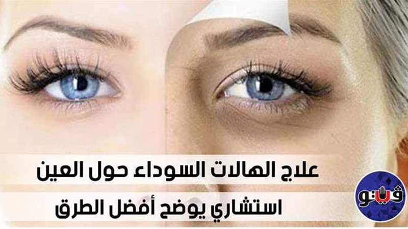 فيتو