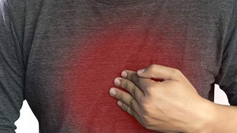 علاج الحموضة وحرقة