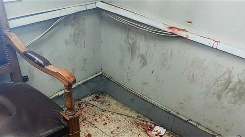 اعتداء زوج على زوجته