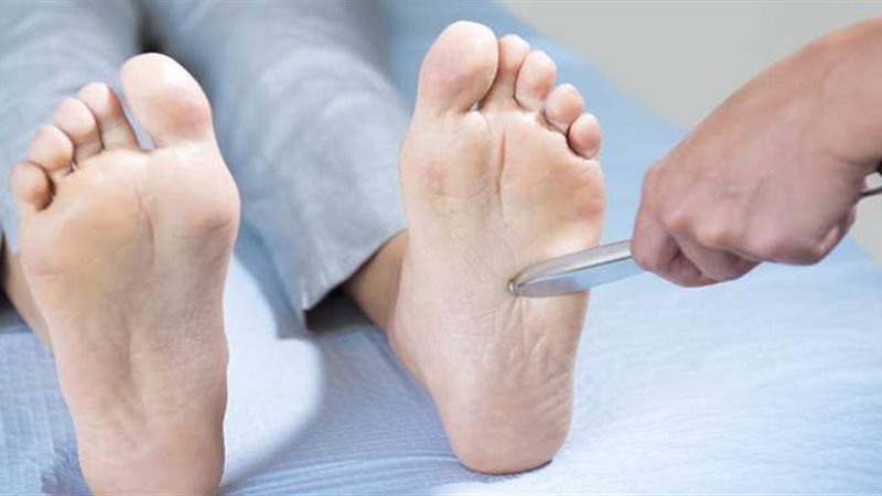 أعراض التهاب الأعصاب
