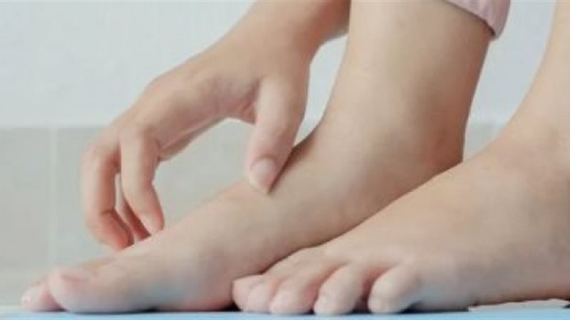 التورم وعلامات الأمراض