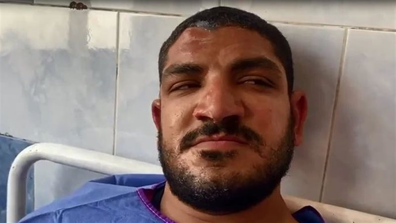 مصاب بحريق كنيسة