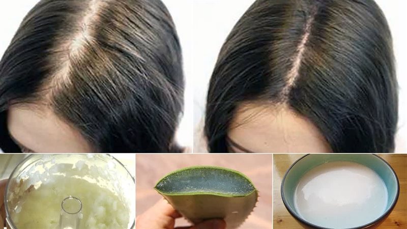 علاج لتساقط الشعر
