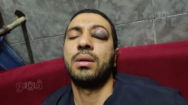 المصاب