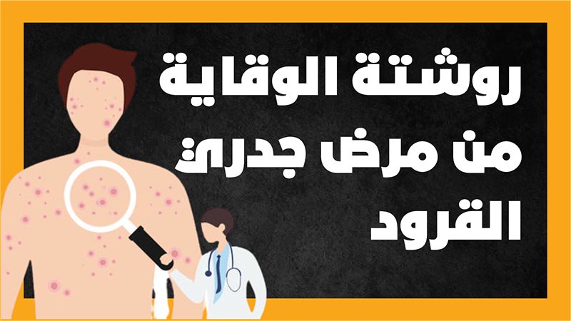 جدري القرود