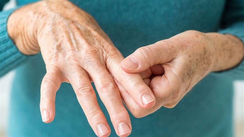 علاج التهاب المفاصل