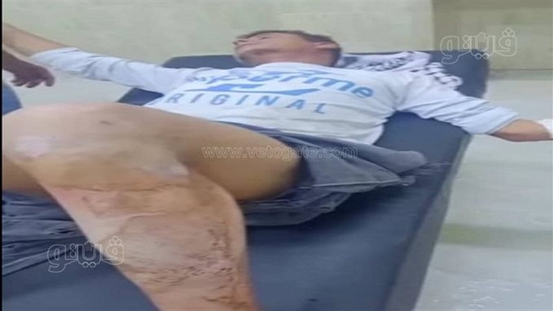 عاطل يصيب مواطنًا