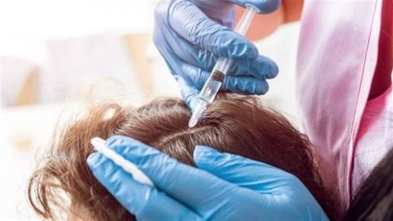 حقن لعلاج تساقط الشعر