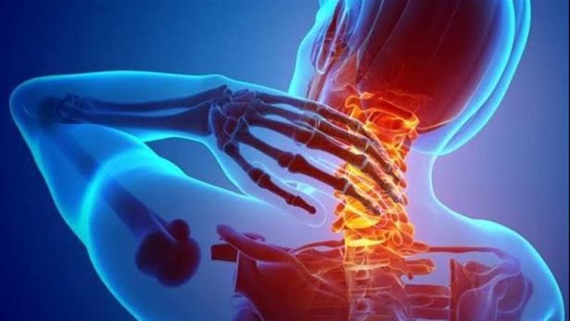 آلام الرقبة