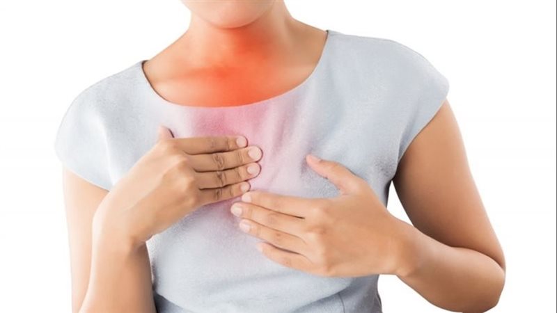 علاج حرقة المعدة