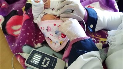 الصحة: فحص سمعي لـ 7 ملايين و881 ألف طفل ضمن مبادرة الكشف المبكر لحديثي الولادة