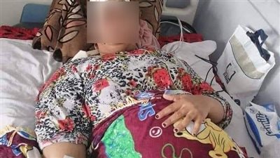 عمليات المعلمين: الاعتداء على معلمة وإصابتها بجروح بالغة فى البحيرة