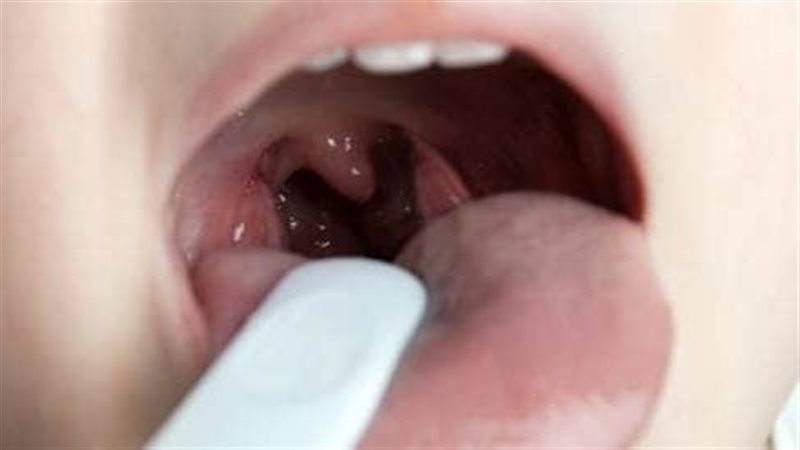 علاج احتقان الزور
