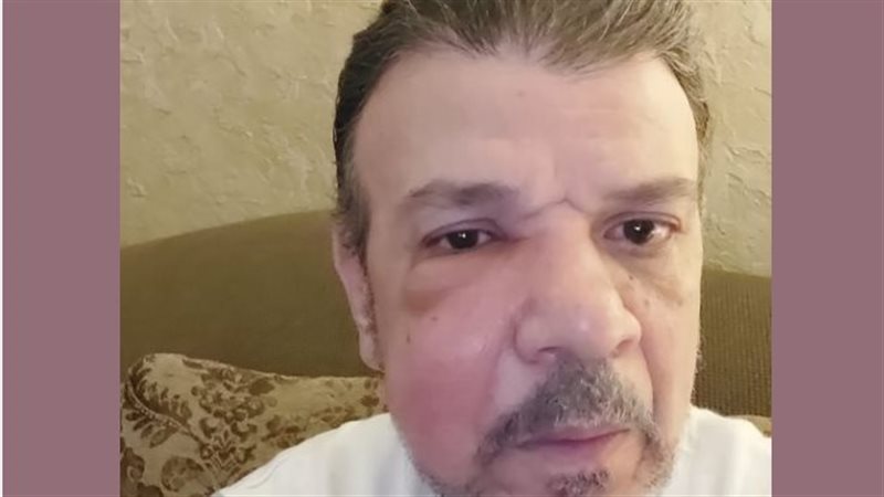 الفنان أحد سلامة