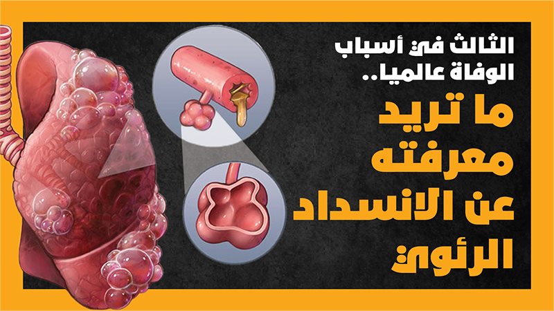 أمراض الرئة