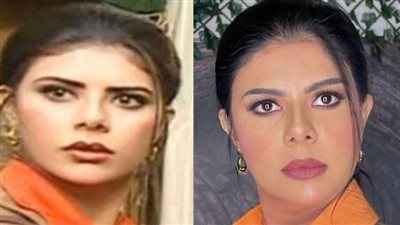  أميرة فتحي تحسم الجدل حول خضوعها لعمليات تجميل