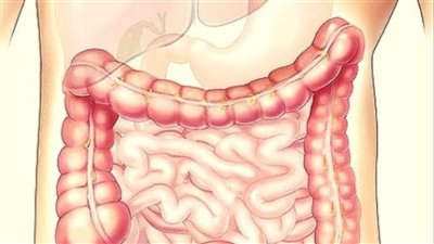 أعراض الزائدة الدودية.. وتشخيصها وطرق العلاج