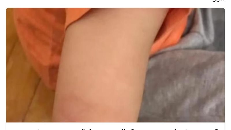 تعذيب أحد الأطفال،