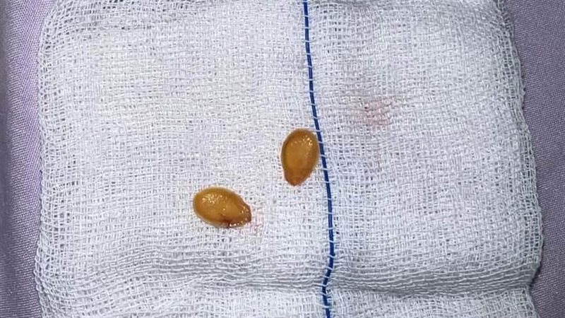 بنها الجامعي، فيتو