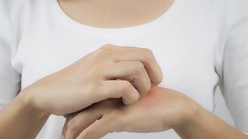 أعراض حساسية الفاكهة،