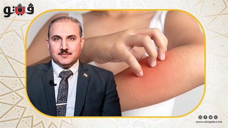 احذر أمراض الجلد،فيتو