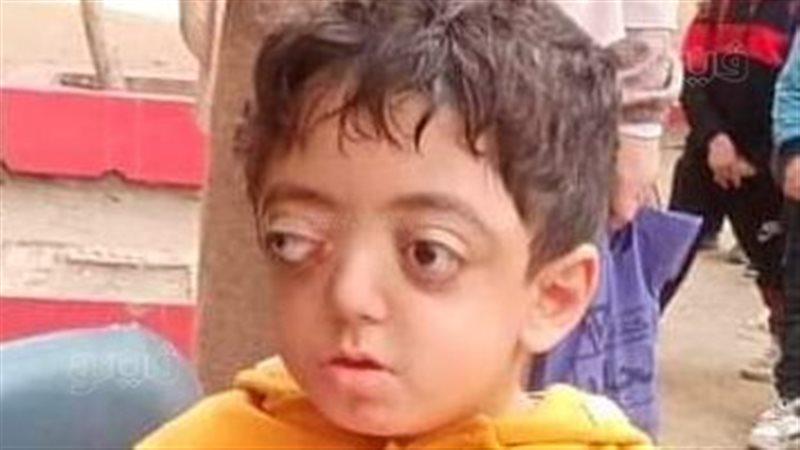 مصطفى،فيتو