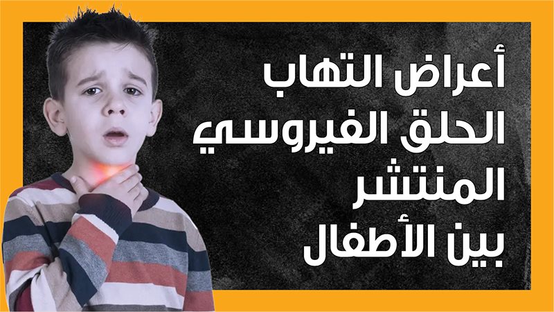 التهاب الحلق، فيتو