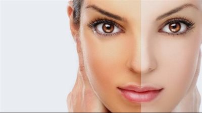 قناع البطاطس المسلوقة لتفتيح البشرة سريعا