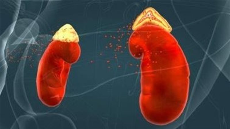 مرض قصور الغدة الكظرية،