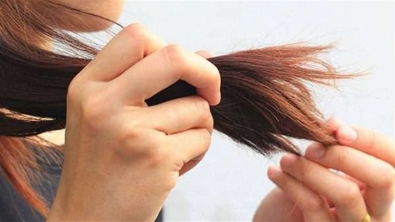 علاج تقصف الشعر،