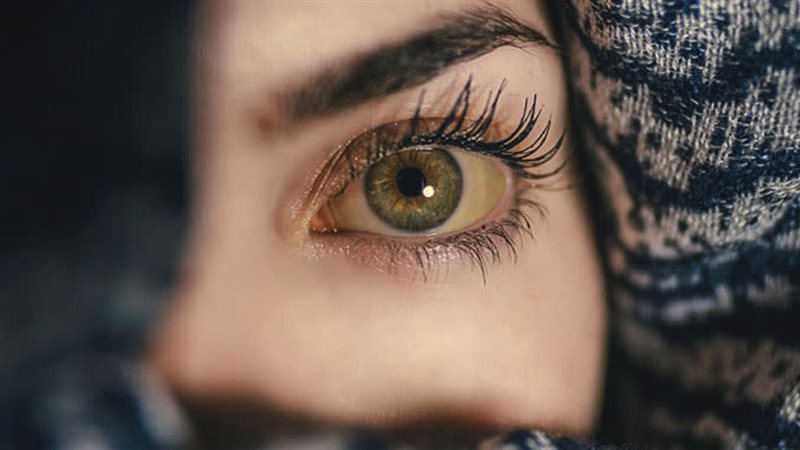 اصفرار العين، فيتو