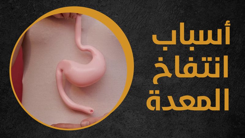 انتفاخ المعدة، فيتو