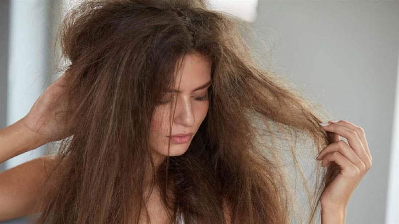 تساقط الشعر، فيتو